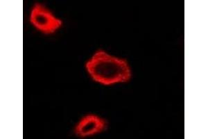 Immunofluorescent analysis of NAT13 staining in A549 cells. (NAA50 antibody)