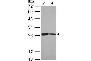 WB Image Sample (30 ug of whole cell lysate) A: Jurkat B: Raji 12% SDS PAGE antibody diluted at 1:1000 (BUD31 antibody)
