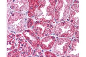 Immunohistochemistry (IHC) image for anti-Signal Transducer and Activator of Transcription 3 (Acute-Phase Response Factor) (STAT3) (N-Term) antibody (ABIN2780479) (STAT3 antibody  (N-Term))