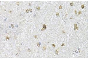 Immunohistochemistry of paraffin-embedded Mouse brain using CMAS Polyclonal Antibody at dilution of 1:150 (40x lens).