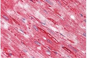 Human Heart: Formalin-Fixed, Paraffin-Embedded (FFPE) (TTYH2 antibody  (N-Term))