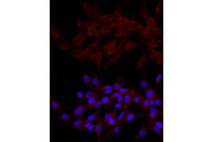 Immunofluorescence analysis of PC-12 cells using NDP52 Rabbit pAb (ABIN6131368, ABIN6137860, ABIN6137861 and ABIN6223210) at dilution of 1:200 (40x lens). (CALCOCO2 antibody  (AA 137-446))