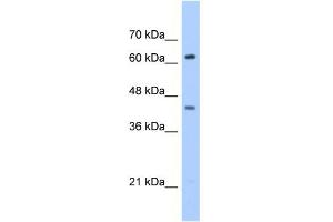 WB Suggested Anti-ZSCAN5D Antibody Titration:  0. (ZSCAN5D antibody  (Middle Region))