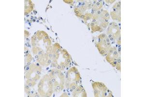 Immunohistochemistry of paraffin-embedded human stomach using C1 antibody (ABIN3016169, ABIN3016170, ABIN3016171 and ABIN6219598) at dilution of 1:100 (40x lens). (ATP2C1 antibody  (AA 400-660))