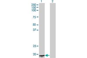 Acyp2 antibody  (AA 1-98)