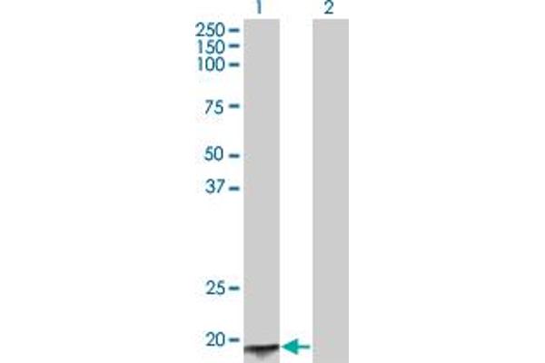 Acyp2 antibody  (AA 1-98)