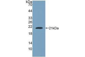 Detection of Recombinant NUP210, Human using Polyclonal Antibody to Nuclear Pore Glycoprotein 210 (gp210) (Nuclear Pore Glycoprotein 210 (AA 1288-1449) antibody)