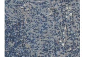 Detection of H-FABP in Porcine Spleen Tissue using Polyclonal Antibody to Heart-type Fatty Acid Binding Protein (H-FABP)