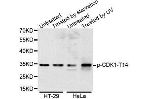 Western Blotting (WB) image for anti-Cyclin-Dependent Kinase 1 (CDK1) (pThr14) antibody (ABIN3019440) (CDK1 antibody  (pThr14))