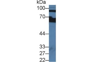 Western blot analysis of Human Serum, using Human CFB Antibody (2 µg/ml) and HRP-conjugated Goat Anti-Rabbit antibody ( (Complement Factor B antibody  (AA 35-160))