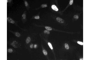 Immunofluorescent staining of HeLa (ATCC CCL-2) cells. (Cyclin E1 antibody)