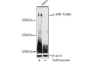 Western blot analysis of extracts of HeLa cells, using Phospho-ATR-T1989 antibody (ABIN7265777) at 1:1000 dilution.