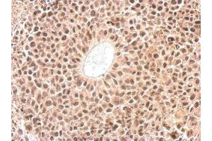 IHC-P Image Cyclophilin E antibody detects PPIE protein at nucleus on HeLa xenograft by immunohistochemical analysis. (PPIE antibody)
