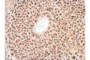 IHC-P Image Cyclophilin E antibody detects PPIE protein at nucleus on HeLa xenograft by immunohistochemical analysis. (PPIE antibody)