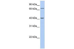 GALNT4 antibody used at 1 ug/ml to detect target protein.