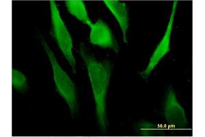 Immunofluorescence of monoclonal antibody to RSAD2 on HeLa cell. (RSAD2 antibody  (AA 262-361))