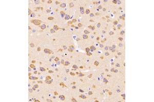Immunohistochemistry (Paraffin-embedded Sections) (IHC (p)) image for anti-Dihydropyrimidinase-Like 4 (DPYSL4) antibody (ABIN7073734)