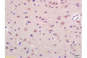 Formalin-fixed and paraffin embedded rat brain labeled with Anti-GRP75 Polyclonal Antibody, Unconjugated (ABIN686992) at 1:200 followed by conjugation to the secondary antibody and DAB staining. (HSPA9 antibody  (AA 561-679))