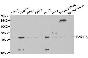 Western blot analysis of extracts of various cell lines, using RAB11A antibody.