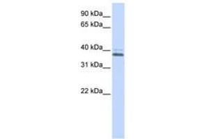 Image no. 1 for anti-ERGIC and Golgi 2 (ERGIC2) (C-Term) antibody (ABIN6740585) (ERGIC2 antibody  (C-Term))