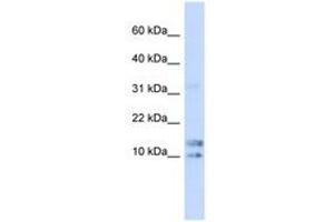 Image no. 1 for anti-Interleukin 15 (IL15) (N-Term) antibody (ABIN6741360) (IL-15 antibody  (N-Term))