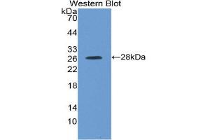 Western Blotting (WB) image for anti-Kallikrein-Related Peptidase 4 (KLK4) (AA 32-256) antibody (ABIN1868867) (Kallikrein 4 antibody  (AA 32-256))