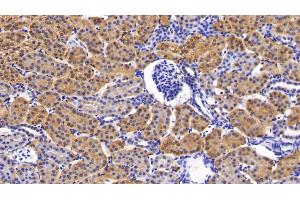 Immunohistochemistry (IHC) image for anti-Phosphoinositide-3-Kinase, Catalytic, beta Polypeptide (PIK3CB) (AA 524-703) antibody (ABIN7436744)