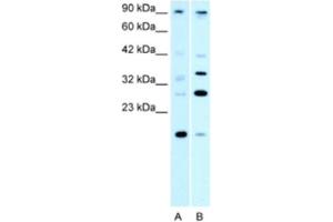 Western Blotting (WB) image for anti-Poly (ADP-Ribose) Polymerase Family, Member 11 (PARP11) antibody (ABIN2460805) (PARP11 antibody)
