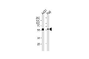 Western blot analysis of lysates from A431, Raji cell line (from left to right), using LYN Antibody (ABIN1944840 and ABIN2843643). (LYN antibody  (AA 1-210))
