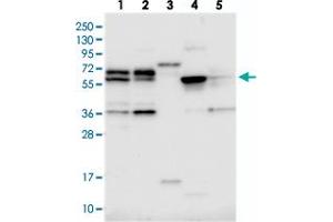 Western blot analysis of Lane 1: RT-4, Lane 2: U-251 MG, Lane 3: Human Plasma, Lane 4: Liver, Lane 5: Tonsil with C15orf52 polyclonal antibody  at 1:250-1:500 dilution. (C15ORF52 antibody)