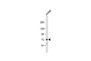 Anti-ZFP36 Antibody (Center) at 1:1000 dilution + Jurkat whole cell lysate Lysates/proteins at 20 μg per lane.