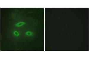 Immunofluorescence analysis of HeLa cells, using NKTR Antibody.