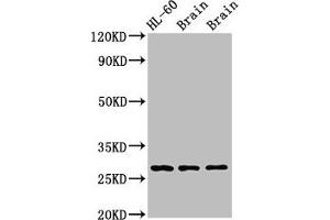 Western Blot Positive WB detected in: Rat brain tissue, Mouse brain tissue All lanes: EMX2 antibody at 2. (EMX2 antibody  (AA 75-141))