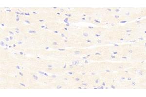 Detection of PDGF BB in Mouse Cardiac Muscle Tissue using Polyclonal Antibody to Platelet Derived Growth Factor BB (PDGF BB) (PDGF-BB Homodimer (AA 21-241) antibody)