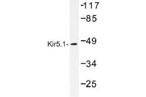 Image no. 1 for anti-Potassium Inwardly-Rectifying Channel, Subfamily J, Member 16 (KCNJ16) antibody (ABIN317797) (KIR5.1 antibody)
