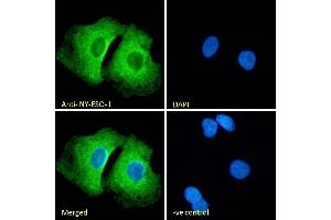 CTAG1B antibody  (Internal Region)