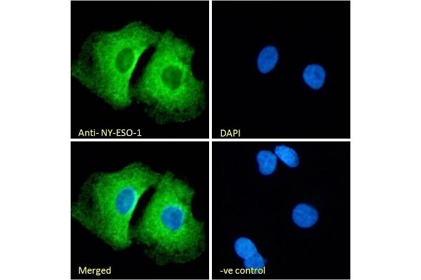 CTAG1B antibody  (Internal Region)
