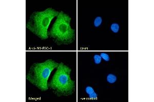 (ABIN570720) Immunofluorescence analysis of paraformaldehyde fixed A549 cells, permeabilized with 0. (CTAG1B antibody  (Internal Region))