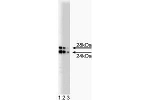Western blot analysis of COMT on a rat pituitary lysate. (COMT antibody  (AA 26-141))