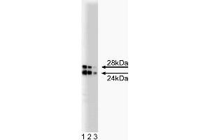 Western blot analysis of COMT on a rat pituitary lysate. (COMT antibody  (AA 26-141))