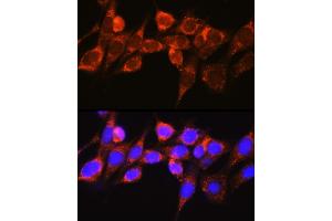 Immunofluorescence analysis of NIH-3T3 cells using Raf1 Rabbit pAb (ABIN3020712, ABIN3020713, ABIN3020714 and ABIN6213686) at dilution of 1:100 (40x lens). (RAF1 antibody  (AA 190-350))
