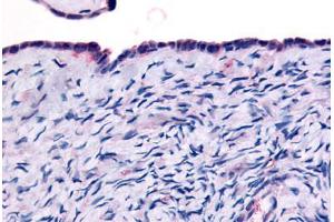 Human Surface Epithelium (formalin-fixed, paraffin-embedded) stained with THRA antibody ABIN213505 at 10 ug/ml followed by biotinylated goat anti-rabbit IgG secondary antibody ABIN481713, alkaline phosphatase-streptavidin and chromogen. (THRA antibody  (Ligand Binding Domain))