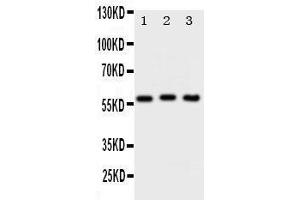 Anti-PKM2 antibody, Western blotting Lane 1: HELA Cell Lysate Lane 2: MCF-7 Cell Lysate Lane 3: A549 Cell Lysate (PKM antibody  (N-Term))