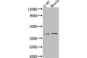 Western Blot Positive WB detected in: U-87 whole cell lysate, Rat Brain whole cell lysate All lanes: NGF antibody at 1:1000 Secondary Goat polyclonal to rabbit IgG at 1/50000 dilution Predicted band size: 27 kDa Observed band size: 39 kDa (Recombinant Nerve Growth Factor antibody)
