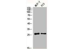 Western Blot analysis of MCF7 PC3 cells using MGMT Polyclonal Antibody (MGMT antibody  (N-Term))