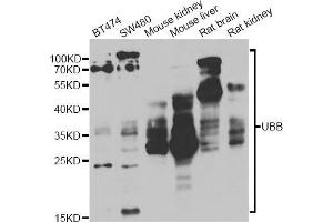 Western blot analysis of extracts of various cell lines, using UBB antibody (ABIN5971156) at 1/1000 dilution. (Ubiquitin B antibody)