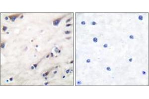 Immunohistochemistry analysis of paraffin-embedded human brain tissue, using KSR (Ab-392) Antibody. (KSR1 antibody  (AA 358-407))