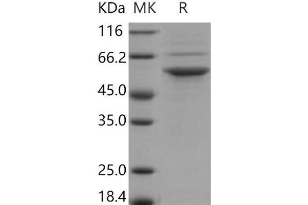 STK24 Protein (His tag)