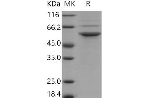 Western Blotting (WB) image for serine/threonine Kinase 24 (STK24) (Active) protein (His tag) (ABIN7317050) (STK24 Protein (His tag))