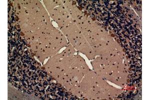 Immunohistochemistry (IHC) image for anti-Chemokine (C-X3-C Motif) Receptor 1 (CX3CR1) (Internal Region) antibody (ABIN6281049)